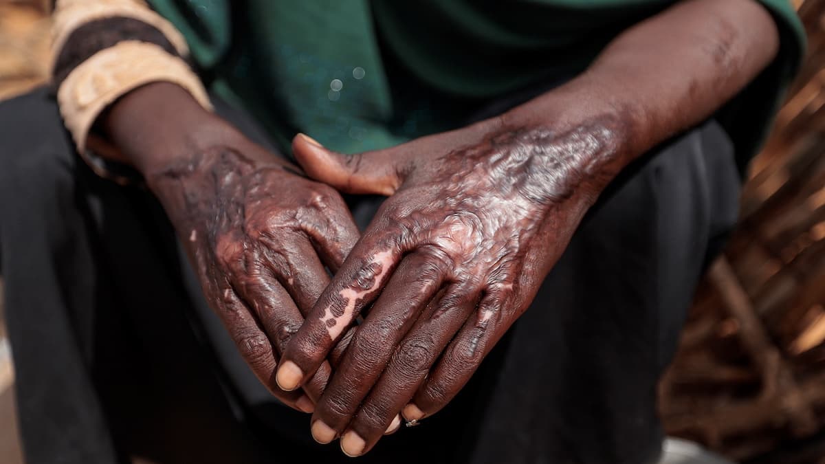 Cover Image for To end the genocide in Sudan, we must divest from the UAE