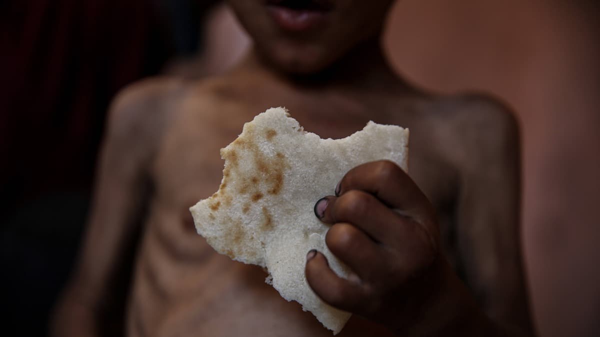 Cover Image for We are starving.